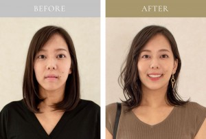 before-after01